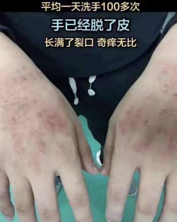 【新华社】全民阻击丨心疼！没想到前方的你是这样的