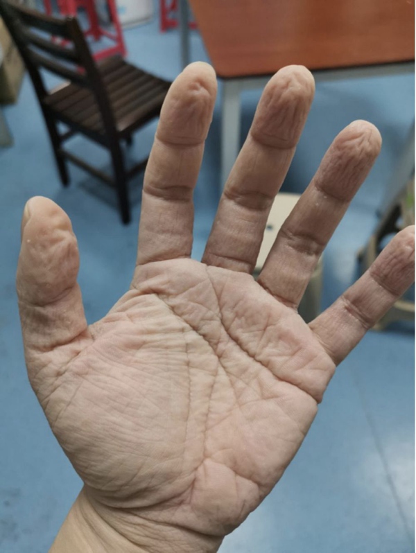 【新华社】全民阻击丨心疼！没想到前方的你是这样的