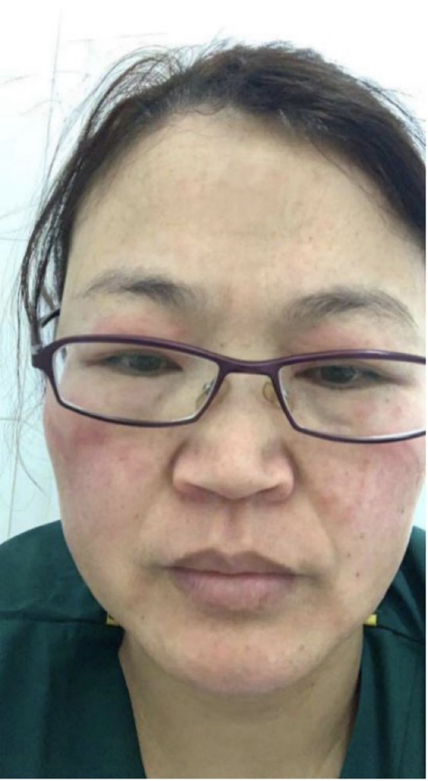 【新华社】全民阻击丨心疼！没想到前方的你是这样的