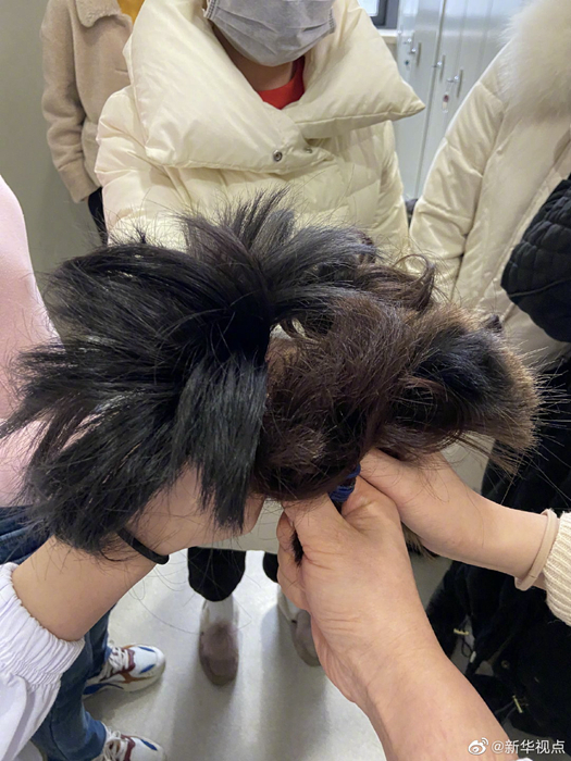 新华网@必胜！武汉协和医院西院31名护士剪发抗“疫”