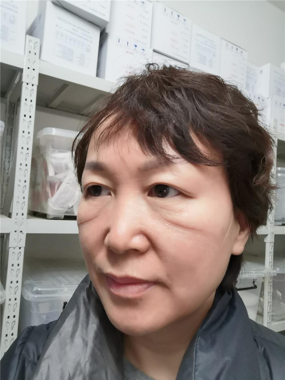 「新华社」凡人亦英雄——连线一线医护人员