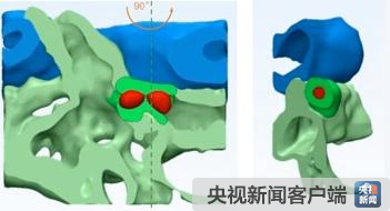 世界首次！我国科学家揭示造血干细胞归巢全过程