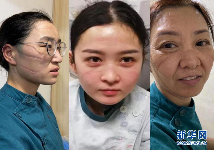 [新华网]多地一线抗疫医务人员工作影像实录