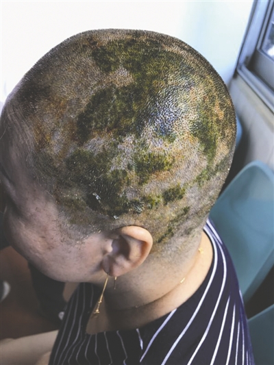 图片默认标题_fororder_1504733705949