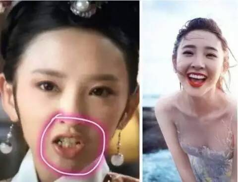 唐艺昕整容了吗