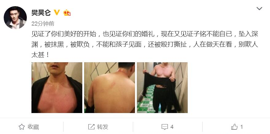 赫子铭被曝遭何洁家暴  知情人：两人尚未离婚