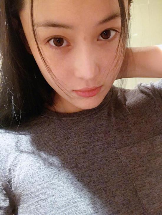 张馨予晒素颜照痘印抢镜：怎么去啊，在线等