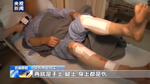 巴基斯坦外长看望恐怖袭击事件中受伤中方人员