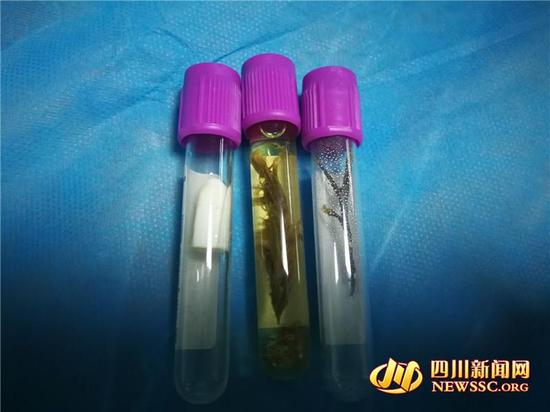 4岁男孩反复咯血 罪魁祸首是鼻子里的狗尾草