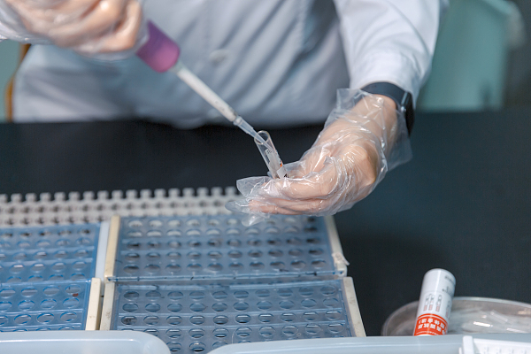 WHO: 228,807,631, bagong naitalang kumpirmadong kaso ng COVID-19 sa buong daigdig; 185 bansa at rehiyon, natuklasan ang kaso ng Delta variant WHO: 228,807,631, bagong naitalang kumpirmadong kaso ng COVID-19 sa buong daigdig; 185 bansa at rehiyon, natuklasan ang kaso ng Delta variant_fororder_02who