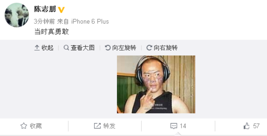陈志朋脸颊烧伤疑毁容? 自评:当时真勇敢