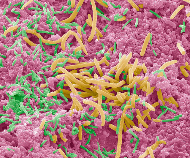 显微镜下的口腔细菌:细长如海洋植物