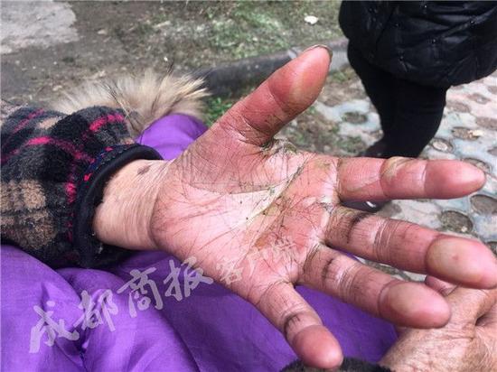 90岁老太家中烧纸引发火灾 第一反应是抢救辣椒酱