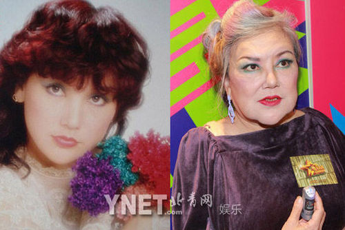 孙菲菲似现整容后遗症 盘点整容的女星