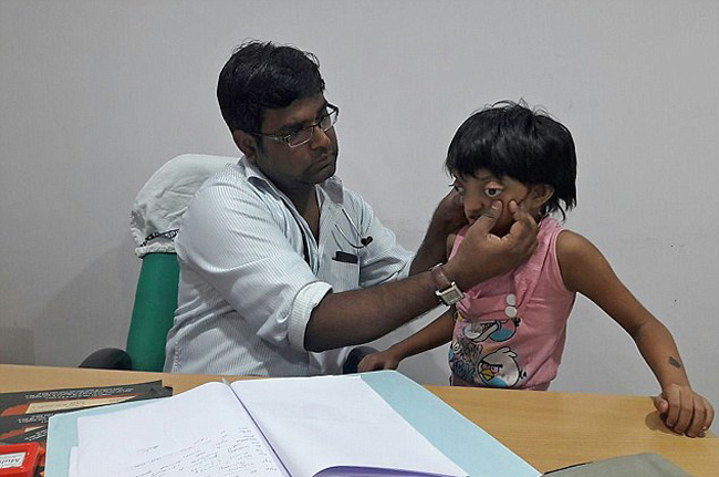 印度女孩患罕见病长”青蛙眼“ 饱受痛苦欺凌(组图)