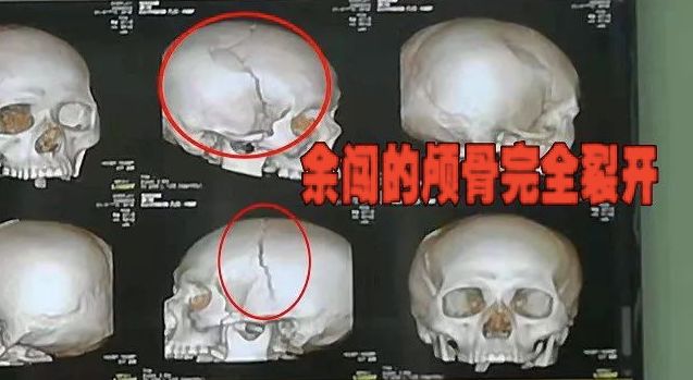 余闯，回来了！