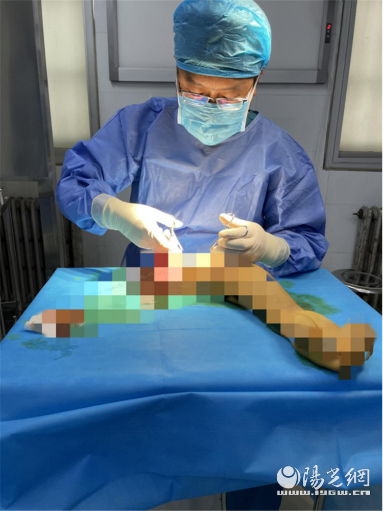 （转载）西安市红会医院骨显微修复外科成功完成高难度复杂断臂再植手术