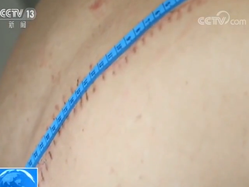 军人本色！退伍老兵见义勇为 身负重伤