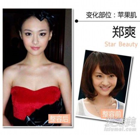 王思聪女友张予曦整容前后照曝光 90后女星整形秘密