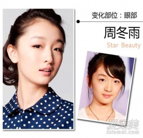 王思聪女友张予曦整容前后照曝光 90后女星整形秘密