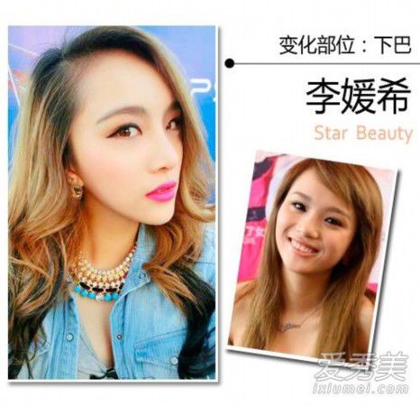王思聪女友张予曦整容前后照曝光 90后女星整形秘密