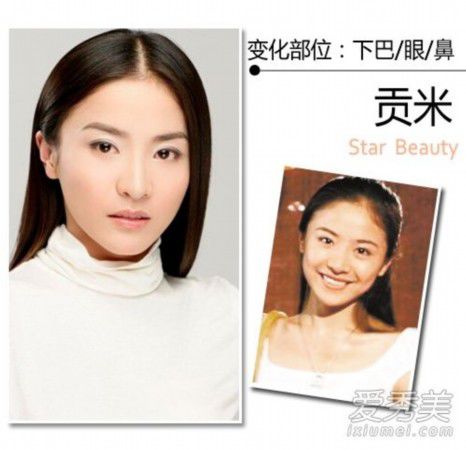 王思聪女友张予曦整容前后照曝光 90后女星整形秘密