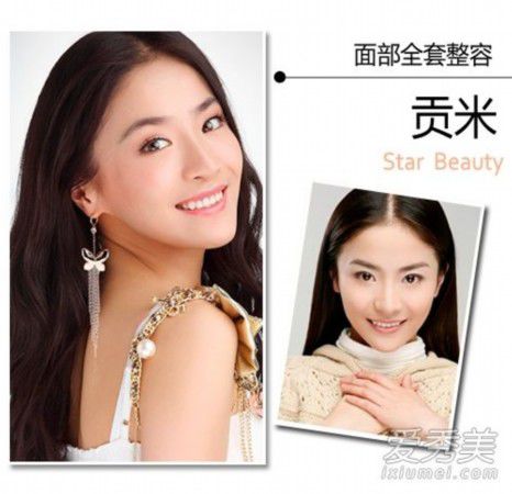 王思聪女友张予曦整容前后照曝光 90后女星整形秘密