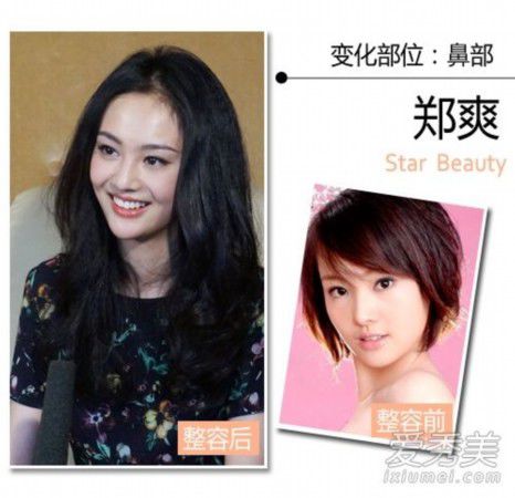王思聪女友张予曦整容前后照曝光 90后女星整形秘密