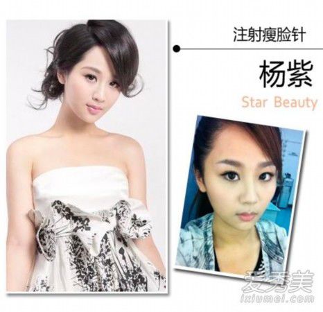 王思聪女友张予曦整容前后照曝光 90后女星整形秘密