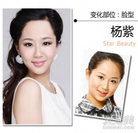 王思聪女友张予曦整容前后照曝光 90后女星整形秘密