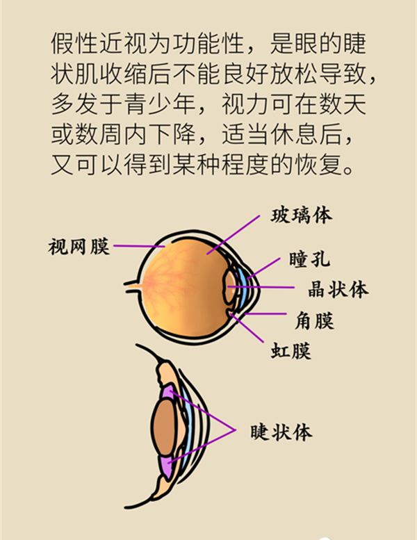 孩子近视了还能恢复正常吗？5招教你延缓度数增长