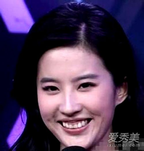 林心如高圆圆刘亦菲也丑过!曾被一口烂牙毁容