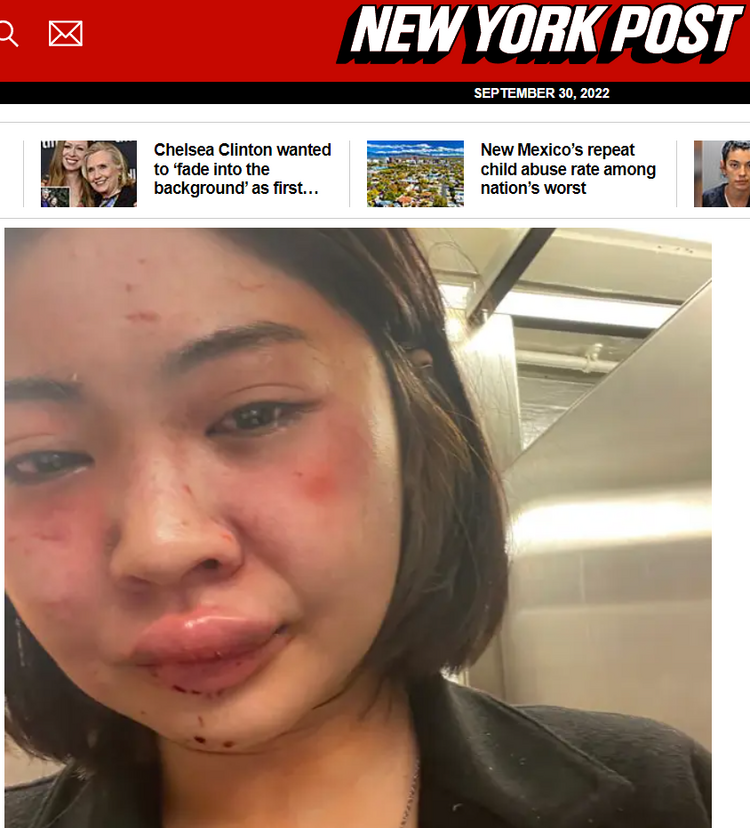 【世界说】纽约地铁女性遭重袭数据飙升安全感急剧下降 美媒：这是现代史上最糟糕的一刻