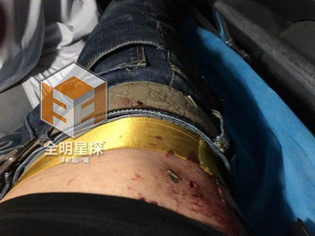 演员俞露车祸身亡 盘点意外去世的明星(组图)