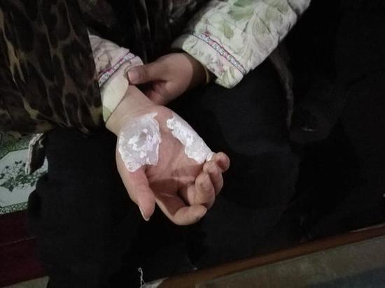 11岁男孩只身扑灭山火 爸爸点赞并告诫先报警