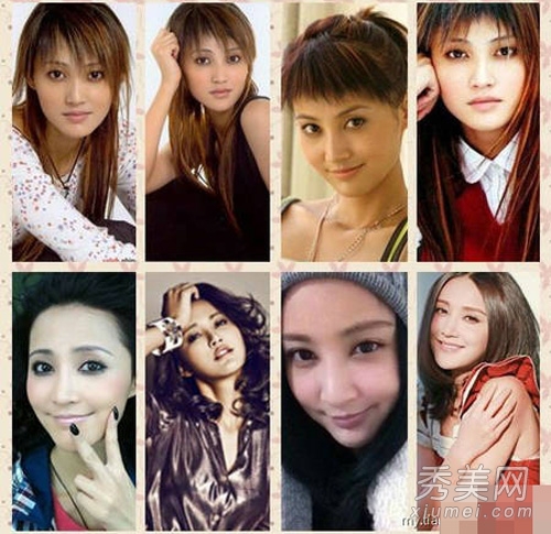 11位女星越整越丑 李小璐张歆艺杨幂脸变形