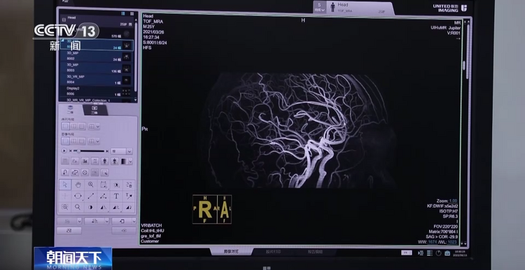 生产线上的中国丨核磁共振技术突破国外长期封锁 这家研究院是如何做到的?