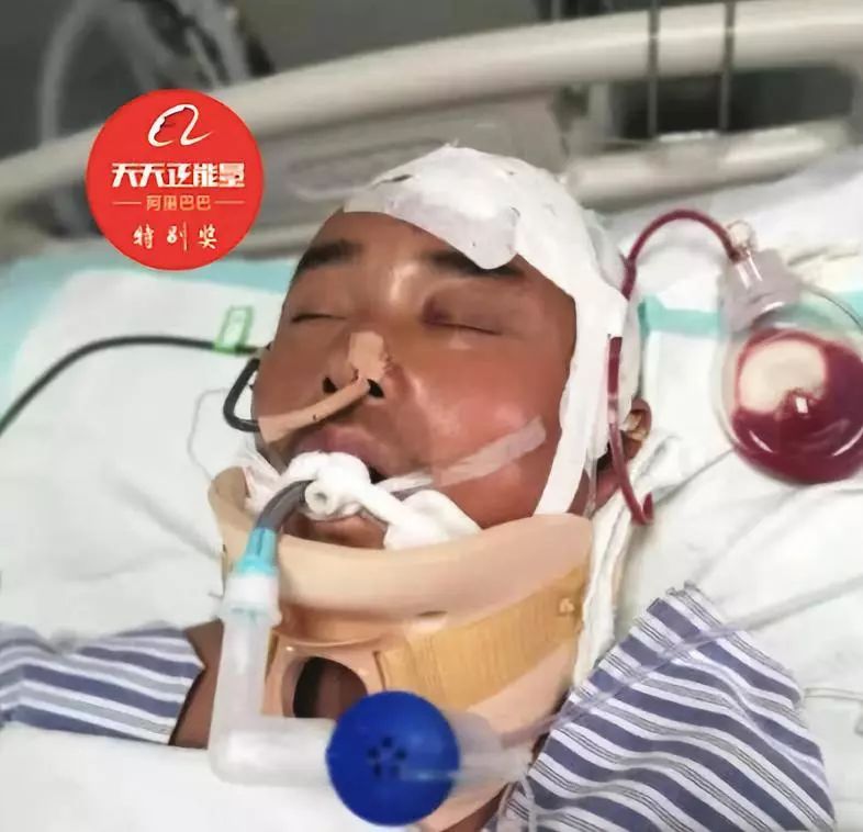 【新华社】农民工冒死救陌生孩子重伤，醒来后先问：“孩子没事儿