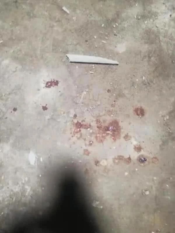 【新华社】农民工冒死救陌生孩子重伤，醒来后先问：“孩子没事儿