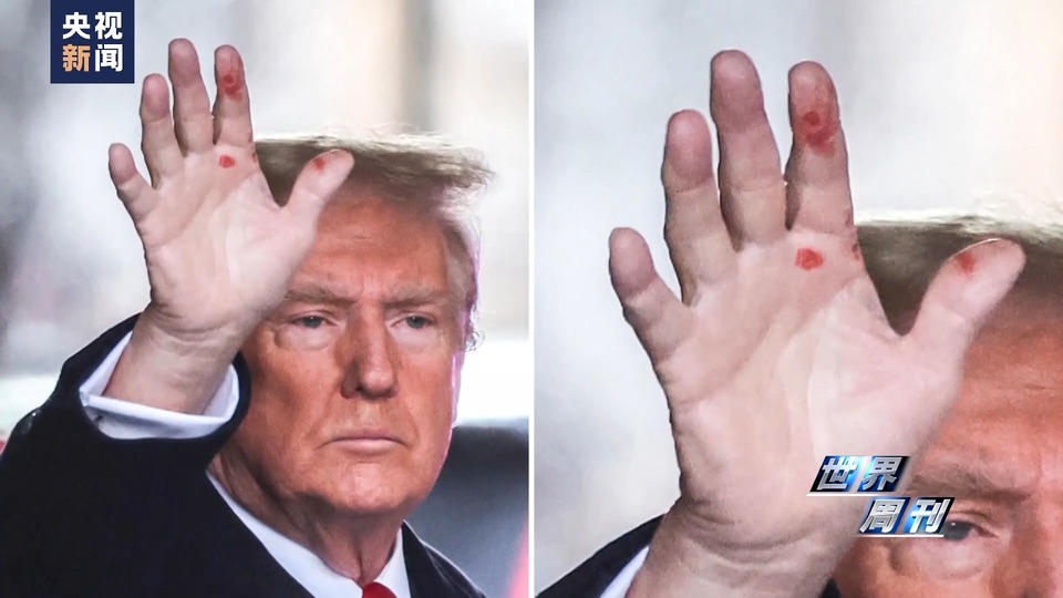 世界周刊丨“撕裂”之战