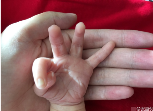 "紫菱"张嘉倪升级当妈妈 晒宝宝小手照报喜(图)