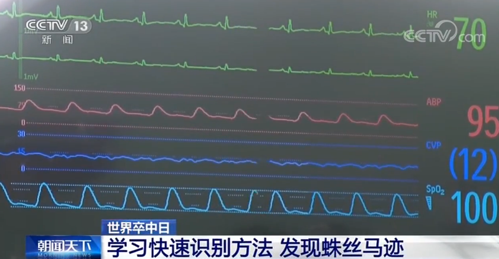 央视网：世界卒中日：远离卒中 从健康生活开始