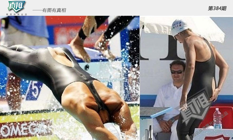 三亿体育科技股份有限公司亲历多次耗材改革后骨科医生说说手术机器人收费限价(图1)