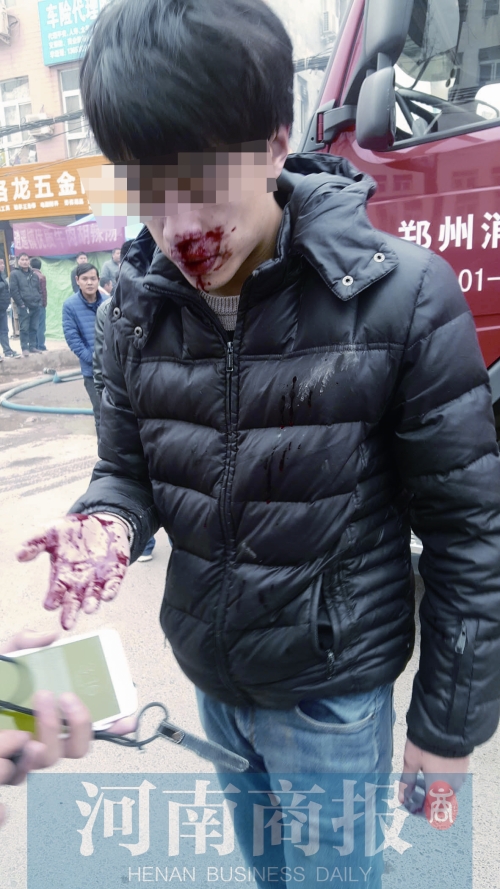 Zhengzhou Cao Cao Township, a factory fire more than reporters were beaten