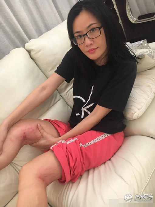 当演员不宜 女星拍古装戏腿部腰部被划伤(组图)