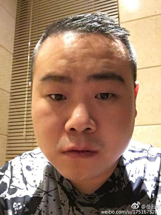 岳云鹏熬夜自拍表情呆马丽的这句话亮了