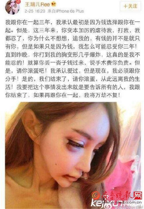 网红王瑞儿遭家暴！百万假胸被打到爆炸