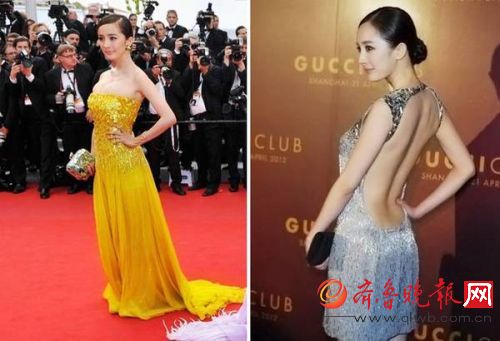 杨幂颈部前倾 原来娜扎、陈伟霆都是她的病友