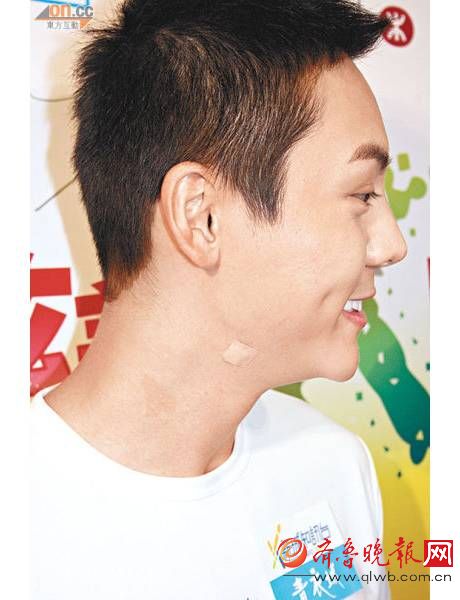 杨幂颈部前倾 原来娜扎、陈伟霆都是她的病友