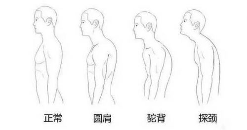 杨幂颈部前倾 原来娜扎、陈伟霆都是她的病友
